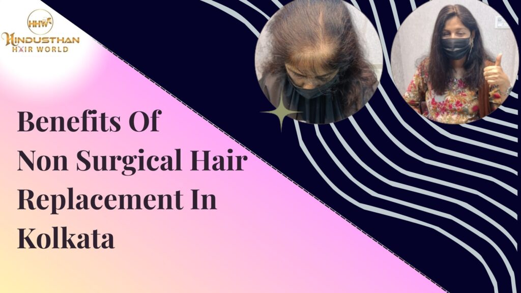 Non Surgical Hair Replacement In Kolkata by Hindusthan Hair World
