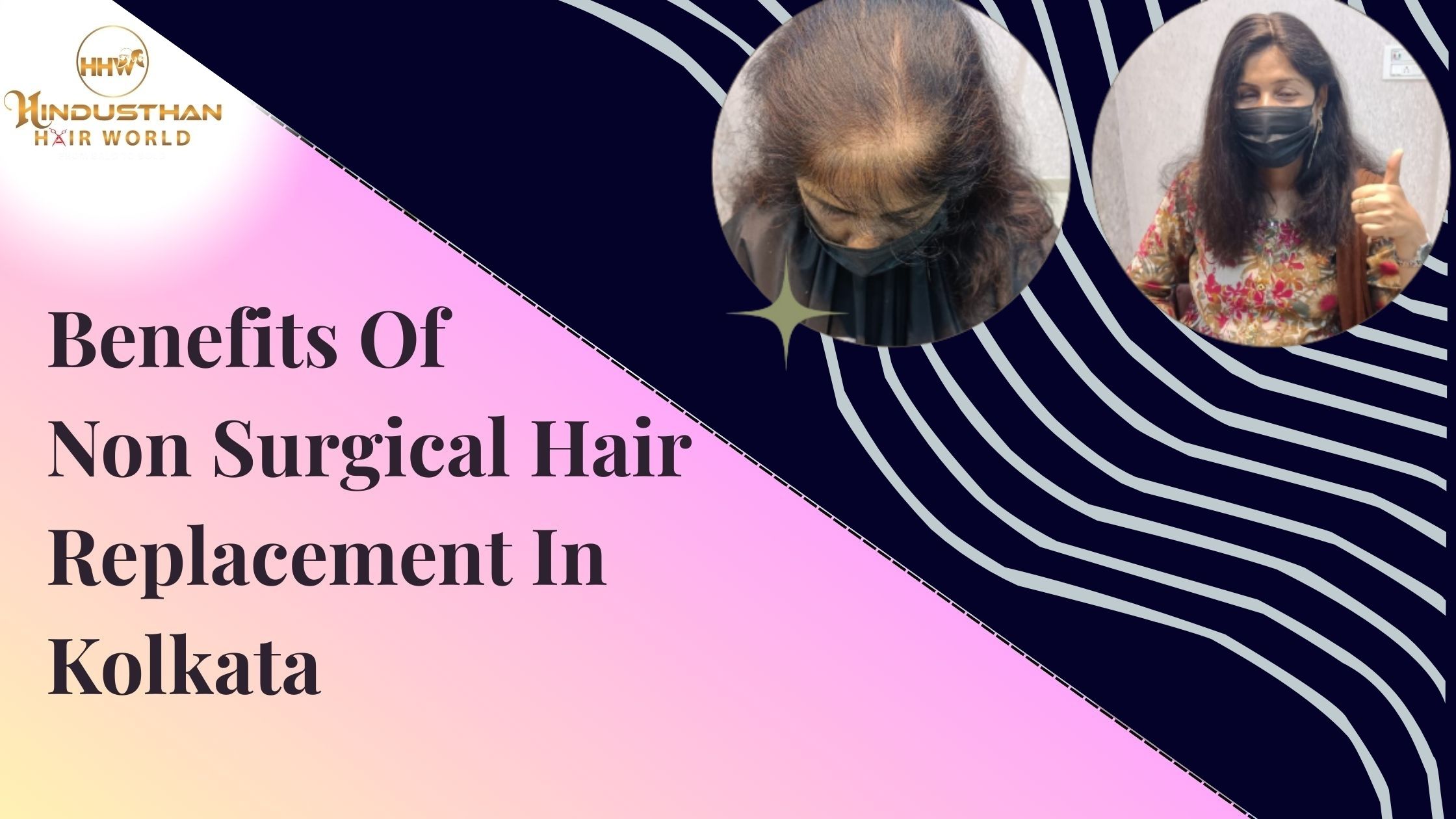 Non Surgical Hair Replacement In Kolkata by Hindusthan Hair World