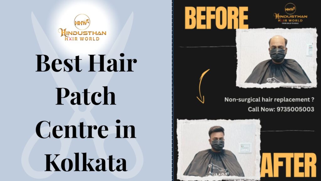 Best Hair Patch Centre in Kolkata in the Non-Surgical is the Way!