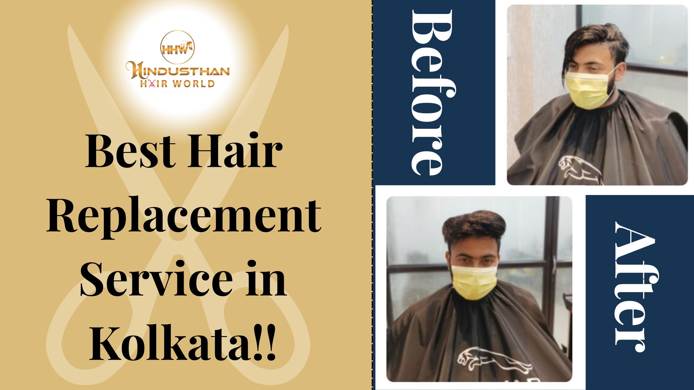 Best Hair Replacement Service in Kolkata for You